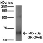 GRK5 Antibody in Western Blot (WB)