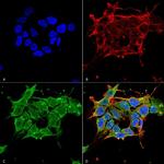 GABRE Antibody in Immunocytochemistry (ICC/IF)