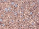 GABRB3 Monoclonal Antibody (N87/25)