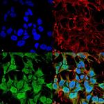 GABRA5 Monoclonal Antibody (N415/24)