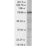 CACNB1 Antibody in Western Blot (WB)