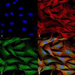ATP7A Monoclonal Antibody (L60/4)