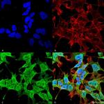 Pan Ankyrin Antibody in Immunocytochemistry (ICC/IF)