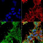 alpha-2c Adrenergic Receptor Antibody in Immunocytochemistry (ICC/IF)
