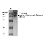 alpha-2c Adrenergic Receptor Antibody in Western Blot (WB)