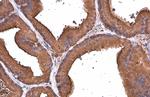 ALDH1A3 Antibody in Immunohistochemistry (Paraffin) (IHC (P))