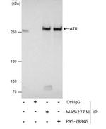 Phospho-ATR (Thr1989) Antibody in Immunoprecipitation (IP)