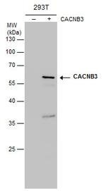 CACNB3 Monoclonal Antibody (7D1)