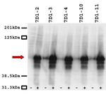 CACNB3 Antibody in Western Blot (WB)