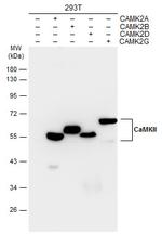 CaMKII delta Monoclonal Antibody (GT4811)