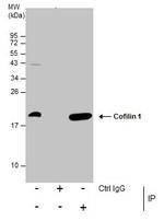Cofilin Antibody in Immunoprecipitation (IP)