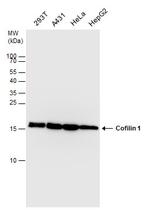 Cofilin Antibody in Western Blot (WB)