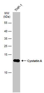 Cystatin A Monoclonal Antibody (GT2264)