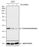 Fumarase Antibody in Western Blot (WB)
