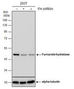 Fumarase Antibody in Western Blot (WB)