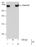 Filamin B Antibody in Immunoprecipitation (IP)