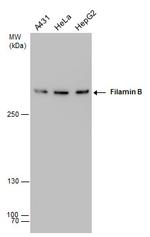 Filamin B Antibody in Western Blot (WB)