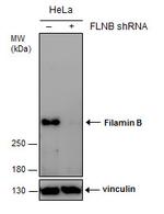 Filamin B Antibody