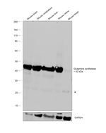 Glutamine Synthetase Antibody in Western Blot (WB)
