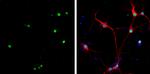 HMGB1 Monoclonal Antibody (GT427)