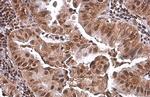 PRMT1 Antibody in Immunohistochemistry (Paraffin) (IHC (P))