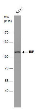 IDE Antibody in Western Blot (WB)