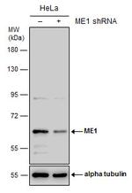 ME1 Antibody in Western Blot (WB)