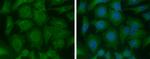 ME1 Monoclonal Antibody (GT979)