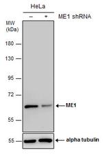 ME1 Antibody in Western Blot (WB)