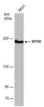 MYH9 Antibody in Western Blot (WB)