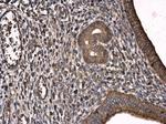 PLS3 Antibody in Immunohistochemistry (Paraffin) (IHC (P))