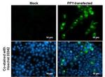 PPY Monoclonal Antibody (GT6512)