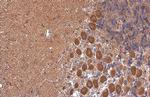 RHEB Antibody in Immunohistochemistry (Paraffin) (IHC (P))
