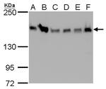 ROCK1 Monoclonal Antibody (GT261)