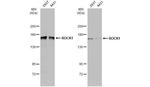 ROCK1 Antibody in Western Blot (WB)