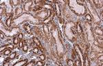 SDHA Antibody in Immunohistochemistry (Paraffin) (IHC (P))