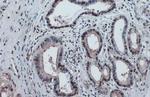 Phospho-p53 (Ser46) Antibody in Immunohistochemistry (Paraffin) (IHC (P))