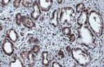 Phospho-p53 (Ser46) Antibody in Immunohistochemistry (Paraffin) (IHC (P))