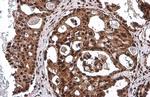 Phospho-p53 (Ser46) Antibody in Immunohistochemistry (Paraffin) (IHC (P))