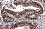 Phospho-p53 (Ser46) Antibody in Immunohistochemistry (Paraffin) (IHC (P))