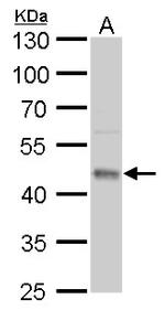 UQCRC1 Antibody in Western Blot (WB)