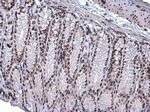 ARID1A Antibody in Immunohistochemistry (Paraffin) (IHC (P))