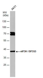 eIF3h Antibody in Western Blot (WB)