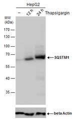 SQSTM1 Antibody in Western Blot (WB)