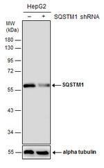 SQSTM1 Antibody in Western Blot (WB)