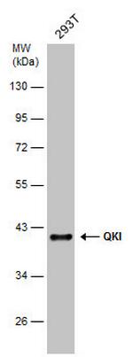 QKI Antibody in Western Blot (WB)