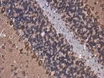 ROCK2 Antibody in Immunohistochemistry (Paraffin) (IHC (P))
