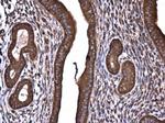 ROCK2 Antibody in Immunohistochemistry (Paraffin) (IHC (P))
