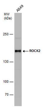 ROCK2 Antibody in Western Blot (WB)