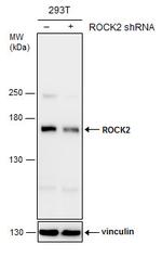 ROCK2 Antibody in Western Blot (WB)